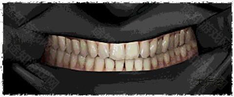 寻找伪人正式版