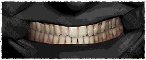 寻找伪人正式版