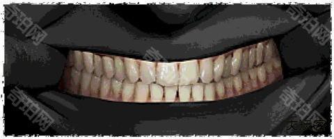 寻找伪人正式版