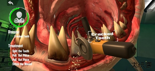 巨兽牙医模拟器